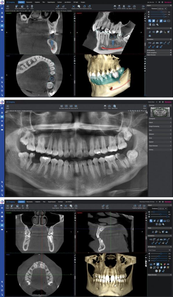 Romexis røntgen software